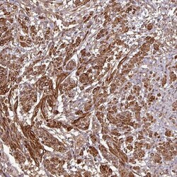MAP3K6 Antibody, Novus Biologicals:Antibodies:Primary Antibodies